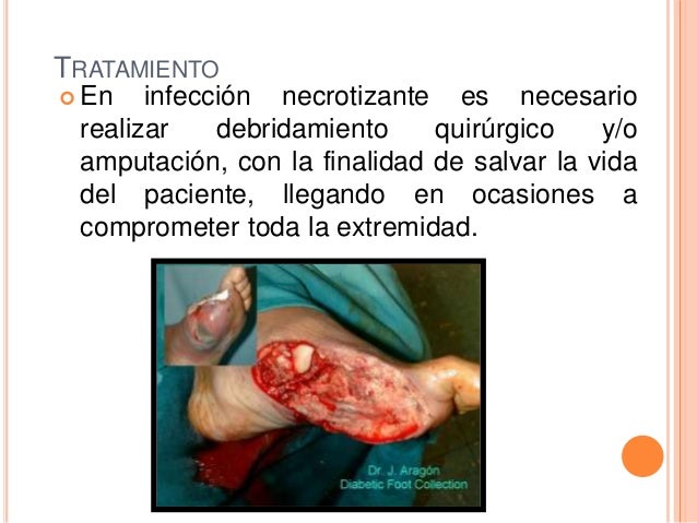 Del producto adelgazante y el cambio de las sustancias para ello en