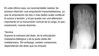 En este último caso, es recomendable realizar de
primera intención una amputación transmetatarsina, ya
que la amputación de dos o más dedos suele conllevar
la sutura a tensión, y el pie queda con una alteración
importante en la transmisión normal de la carga, lo que
ocasionará, nuevas lesiones.
Técnica
Supone la exéresis del dedo, de la articulación
metatarso-falángica y de la parte distal del
metatarsiano. Sin embargo, existen variaciones
dependiendo del dedo que se ampute:
 