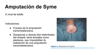 Amputación de Syme
A nivel de tobillo
Indicaciones
● Fracaso de la amputación
transmetatarsiana.
● Gangrenas o úlceras bien delimitadas
del antepié, tanto dorsales como
plantares, que imposibiliten la
realización de una amputación
transmetatarsiana.
 