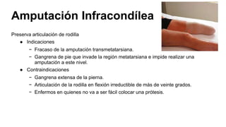 Preserva articulación de rodilla
● Indicaciones
− Fracaso de la amputación transmetatarsiana.
− Gangrena de pie que invade la región metatarsiana e impide realizar una
amputación a este nivel.
● Contraindicaciones
− Gangrena extensa de la pierna.
− Articulación de la rodilla en flexión irreductible de más de veinte grados.
− Enfermos en quienes no va a ser fácil colocar una prótesis.
Amputación Infracondílea
 