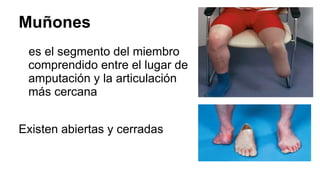 Muñones
es el segmento del miembro
comprendido entre el lugar de
amputación y la articulación
más cercana
Existen abiertas y cerradas
 