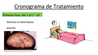 Cronograma de Tratamiento
Primera Fase: día 1 al 7 - 10
Disminuir el dolor/reposo
posición
 