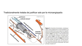 Tradicionalmente trataba de justificar solo por la microangiopatía
 