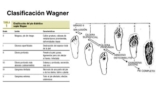Clasificación Wagner
 