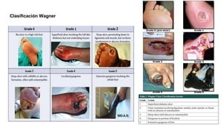 Clasificación Wagner
 