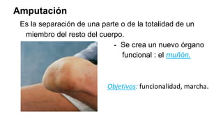 Amputación
Es la separación de una parte o de la totalidad de un
miembro del resto del cuerpo.
- Se crea un nuevo órgano
funcional : el muñón.
Objetivos: funcionalidad, marcha.
 