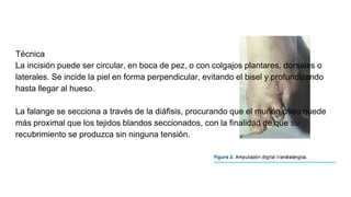 Técnica
La incisión puede ser circular, en boca de pez, o con colgajos plantares, dorsales o
laterales. Se incide la piel en forma perpendicular, evitando el bisel y profundizando
hasta llegar al hueso.
La falange se secciona a través de la diáfisis, procurando que el muñón óseo quede
más proximal que los tejidos blandos seccionados, con la finalidad de que su
recubrimiento se produzca sin ninguna tensión.
 