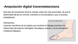 -Amputación digital transmetatarsiana
Este tipo de amputación tiene la ventaja, sobre las más proximales, de que la
deformidad del pie es mínima, mantiene su funcionalidad y que no precisa
rehabilitación
Indicaciones
Lesiones necróticas de los tejidos que recubren la falange proximal con
indemnidad del espacio interdigital, del pliegue cutáneo y de la articulación
metatarso-falángica.
 