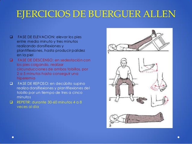 Pie diabetico manejo transdisciplinario Pie diabetico manejo transdisciplinario