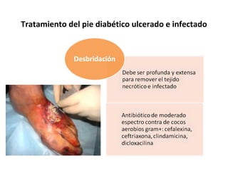 Tratamiento del pie diabético ulcerado e infectado
 