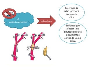 La
endarterectomía
Enfermos de
edad inferior a
los sesenta
años
Lesiones que
afectan a la
bifurcación ilíaca
o segmentos
cortos de un eje
ilíaco
Indicado en
No muy
usado
 