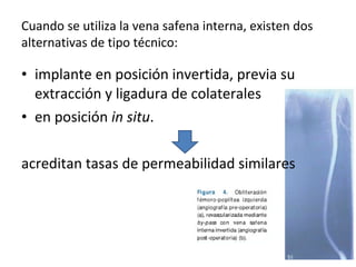 Cuando se utiliza la vena safena interna, existen dos
alternativas de tipo técnico:
• implante en posición invertida, previa su
extracción y ligadura de colaterales
• en posición in situ.
acreditan tasas de permeabilidad similares
 