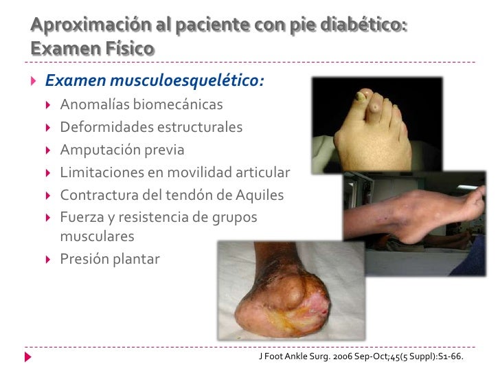 Pie diabético Pie diabético