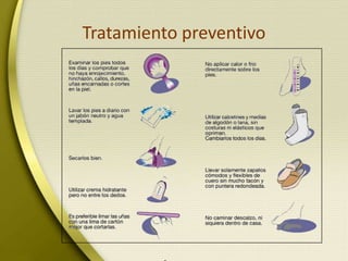 Tratamiento preventivo
 