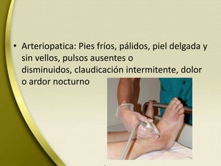 • Arteriopatica: Pies fríos, pálidos, piel delgada y
sin vellos, pulsos ausentes o
disminuidos, claudicación intermitente, dolor
o ardor nocturno
 
