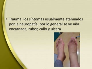 • Trauma: los síntomas usualmente atenuados
por la neuropatía, por lo general se ve uña
encarnada, rubor, callo y ulcera
 