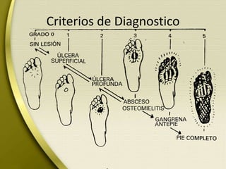 Criterios de Diagnostico
 
