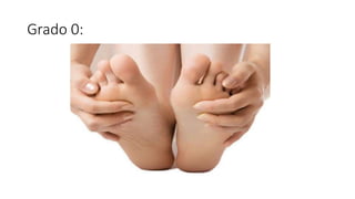 Grado 0:
 