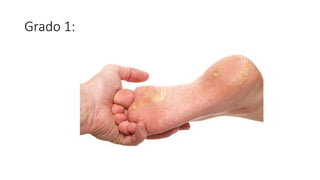 Grado 1:
 