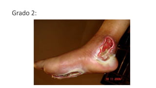 Grado 2:
 
