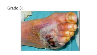 Grado 3:
 