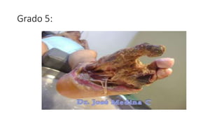 Grado 5:
 