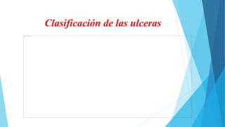 Clasificación de las ulceras
 