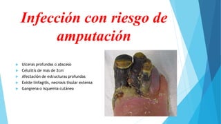 Infección con riesgo de
amputación
 Ulceras profundas o absceso
 Celulitis de mas de 2cm
 Afectación de estructuras profundas
 Existe linfagitis, necrosis tisular extensa
 Gangrena o isquemia cutánea
 