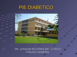 PIE DIABETICO DR. JOAQUIN BECERRA BELLO R3CG CIRUGIA GENERAL 