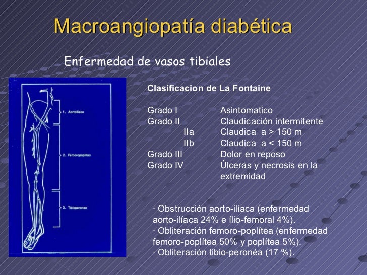 Pie diabético final Pie diabético final