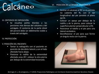 III. CRITERIOS DE EXPOSICIÓN:
 Se visualiza partes blandas y las
porciones más densas del calcáneo y del
astrágalo. El contorno de la parte distal
del peroné debe ser débilmente visible a
través del astrágalo.
IV. PROTECCIÓN:
V. POSICIÓN DEL PACIENTE:
 Tomar la radiografía con el paciente en
posición de decúbito lateral y con el lado
afectado hacia abajo.
 Flexionar la rodilla de la extremidad
afectada unos 45°; colocar la otra pierna
por debajo de la extremidad lesionada.
VI. POSICIÓN DE LA REGIÓN ANATÓMICA:
 Centrar el calcáneo al RC y a la porción
no cubierta del RI, con el eje
longitudinal del pie paralelo al plano
del RI.
 Colocar un apoyo por debajo de la
rodilla y de la pierna, para colocar la
superficie plantar perpendicular al RI.
 Posicionar el tobillo y el pie para una
lateral verdadera.
 Dorsiflexionar el pie para que forme
un ángulo recto con la pierna.
Bontrager, K. L., & Lampignano, J. P. (2010). Proyecciones Radiologicas con Correlacion Anatomica (septima). Barcelona: Elsevier.
 