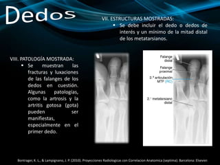 VIII. PATOLOGÍA MOSTRADA:
 Se muestran las
fracturas y luxaciones
de las falanges de los
dedos en cuestión.
Algunas patologías,
como la artrosis y la
artritis gotosa (gota)
pueden ser
manifiestas,
especialmente en el
primer dedo.
Bontrager, K. L., & Lampignano, J. P. (2010). Proyecciones Radiologicas con Correlacion Anatomica (septima). Barcelona: Elsevier.
VII. ESTRUCTURAS MOSTRADAS:
 Se debe incluir el dedo o dedos de
interés y un mínimo de la mitad distal
de los metatarsianos.
 