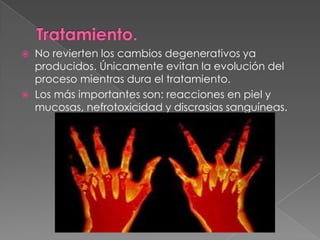   No revierten los cambios degenerativos ya
    producidos. Únicamente evitan la evolución del
    proceso mientras dura el tratamiento.
   Los más importantes son: reacciones en piel y
    mucosas, nefrotoxicidad y discrasias sanguíneas.
 
