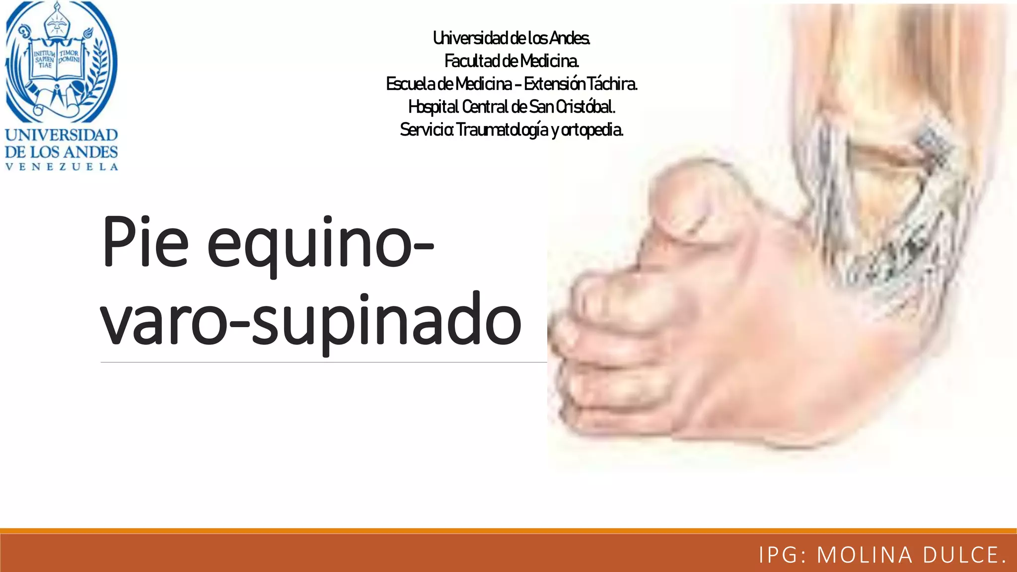 Pie equinovarosupinado.pptx