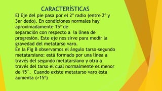CARACTERÍSTICAS
El Eje del pie pasa por el 2º radio (entre 2º y
3er dedo). En condiciones normales hay
aproximadamente 15º de
separación con respecto a la línea de
progresión. Este eje nos sirve para medir la
gravedad del metatarso varo.
En la Fig B observamos el ángulo tarso-segundo
metatarsiano: está formado por una línea a
través del segundo metatarsiano y otra a
través del tarso el cual normalmente es menor
de 15˚. Cuando existe metatarso varo ésta
aumenta (>15º)
 