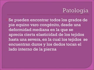 Se pueden encontrar todos los grados de pie equino varo congénito, desde una deformidad mediana en la que se aprecia cierta elasticidad de los tejidos hasta una severa, en la cual los tejidos  se encuentran duros y los dedos tocan el lado interno de la pierna 