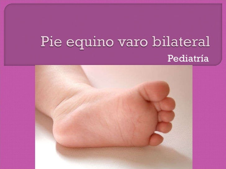 Pie equino varo bilateral