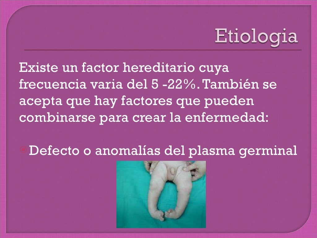 Pie equino varo bilateral