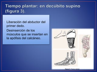 • Liberación del abductor del
primer dedo.
• Desinserción de los
músculos que se insertan en
la apófisis del calcáneo.
 