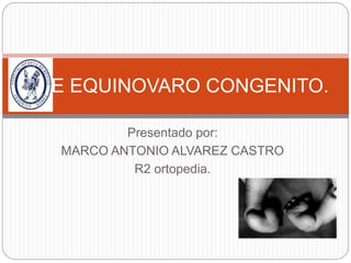 PIE EQUINOVARO CONGENITO. 
Presentado por: 
MARCO ANTONIO ALVAREZ CASTRO 
R2 ortopedia. 
 