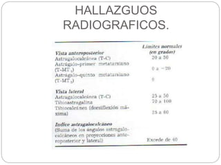 HALLAZGUOS 
RADIOGRAFICOS. 
 