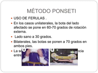 MÉTODO PONSETI 
 USO DE FERULAS . 
 En los casos unilaterales, la bota del lado 
afectado se pone en 60-70 grados de rotación 
externa. 
 Lado sano a 30 grados. 
 Bilaterales, las botas se ponen a 70 grados en 
ambos pies. 
 La separación entre las botas es la distancia 
entre la región lateral de de los hombros. 
 