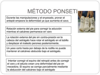 MÉTODO PONSETI 
Durante las manipulaciones y el enyesado, pronar el 
antepié empeora la deformidad ya que aumenta el cavo. 
Rotación externa del pie para corregir la aducción 
mientras el calcáneo permanece en varo 
La rotación externa del pie sin contra-presión en la 
cabeza del astrágalo hace rotar el astrágalo en el tobillo 
y desplazar el maleolo peroneo posteriormente. 
Un yeso corto hasta por debajo de la rodilla no puede 
mantener el calcáneo abducido bajo el astrágalo. 
. 
Intentar corregir el equino del retropié antes de corregir 
el varo y el aducto crean una deformidad del pie en 
mecedora. El equino se corrige parcialmente mediante 
la abducción del calcáneo bajo el astrágalo 
 
