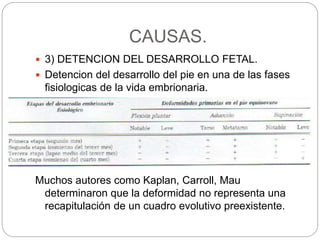 CAUSAS. 
 3) DETENCION DEL DESARROLLO FETAL. 
 Detencion del desarrollo del pie en una de las fases 
fisiologicas de la vida embrionaria. 
Muchos autores como Kaplan, Carroll, Mau 
determinaron que la deformidad no representa una 
recapitulación de un cuadro evolutivo preexistente. 
 