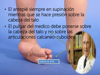 • El antepié siempre en supinación
mientras que se hace presión sobre la
cabeza del talo
• El pulgar del medico debe ponerse sobre
la cabeza del talo y no sobre las
articulaciones calcaneo-cuboidea
ERROR DE KITE
 