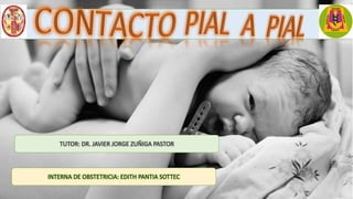 INTERNA DE OBSTETRICIA: EDITH PANTIA SOTTEC
TUTOR: DR. JAVIER JORGE ZUÑIGA PASTOR
 