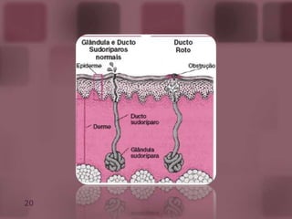 Bolsas serosas subcutáneas: Cavidades labradas en el tejido celular subcutáneo destinadas favorecer el deslizamiento de la piel sobre las capas subyacentes.