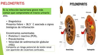 PIELONEFRITIS
• Diagnóstico
Presenta fiebre > 38,5° C asociada a signos
biológicos de inflamación
Encontramos aumentadas
• Proteína C reactiva (PCR),
• Procalcitonina
• Velocidad de sedimentación globular
(VSG)
Comporta un riesgo potencial de lesión renal
con aparición de cicatrices corticales.
Es la infección bacteriana grave más
común que compromete el tracto urinario
alto.
 