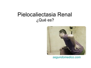 Pielocaliectasia Renal
¿Qué es?
segundomedico.com
 
