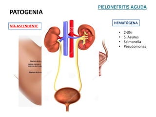 PATOGENIA
PIELONEFRITIS AGUDA
VÍA ASCENDENTE
HEMATÓGENA
• 2-3%
• S. Aeurus
• Salmonella
• Pseudomonas
 